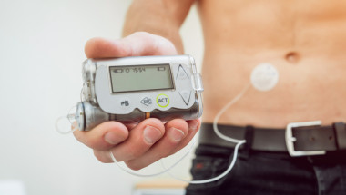 Полага ли се инсулинова помпа  по НЗОК на възрастни пациенти?