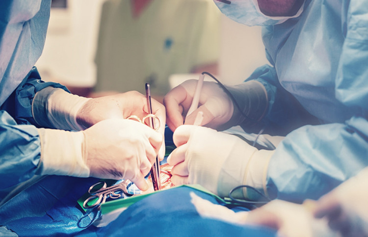 Една четвърт от пациентите с коремна операция развиват херния