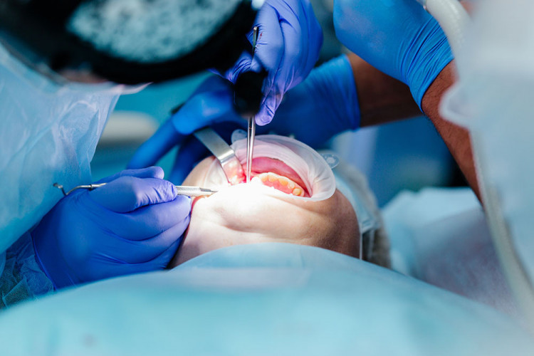 Стоматолог разкри как точно ще изглежда устата ви, ако не се откажете от лошите навици ВИДЕО