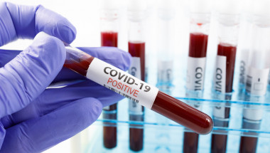 Обширно изследване в Китай установи още едно много тежко последствие от коронавируса
