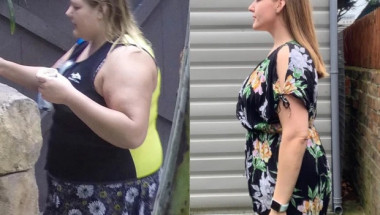 Жена свали 56 кг с диета, която сама измисли, но гледката под дрехите й е покъртителна СНИМКИ