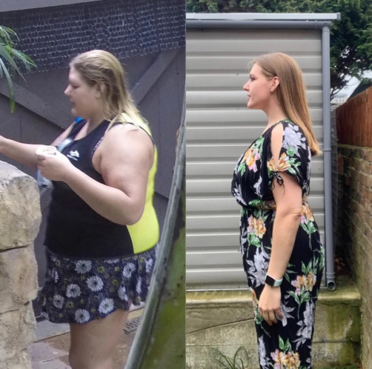Жена свали 56 кг с диета, която сама измисли, но гледката под дрехите й е покъртителна СНИМКИ