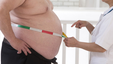 Токсичното затлъстяване не се лекува с диети и спорт