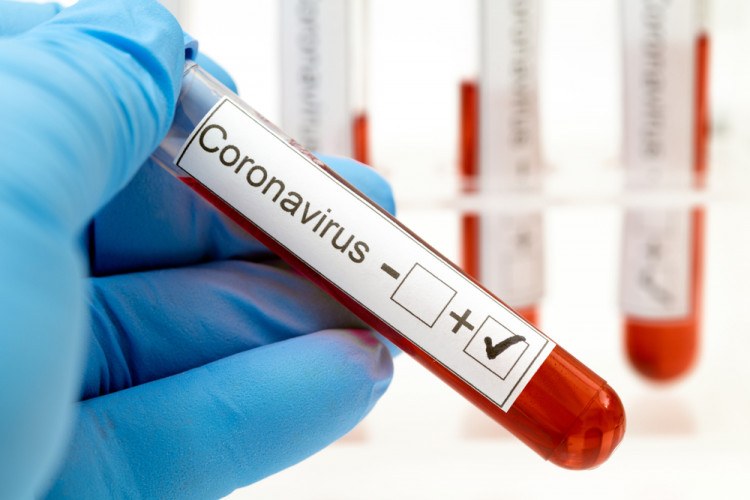 Защо трябва да си платим теста за коронавирус  при прием в болница?