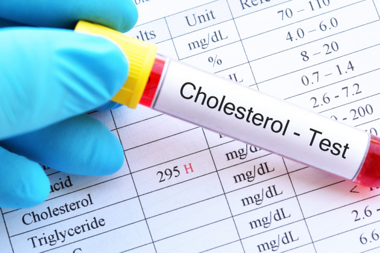 Д-р Красимир Хаджилазов: Генетичен ензимен дефект води до висок холестерол