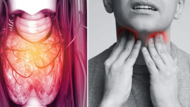 10 признака за рак на гърлото, които не трябва да не се игнорират