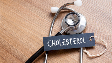 Различна гледна точка по отношение на холестерола и статините
