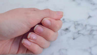Защо се появяват бели петна по ноктите и опасни ли са?