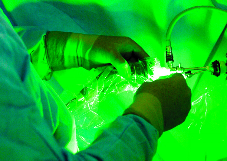 Зелена светлина  изпарява мигновено увеличената простата
