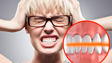 Бруксизмът е една от причините за износване на зъбите