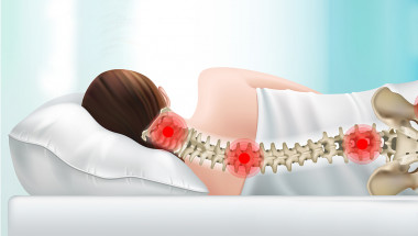 При дискомфорт в шийния отдел на гръбначния стълб не трябва да спите на висока възглавница
