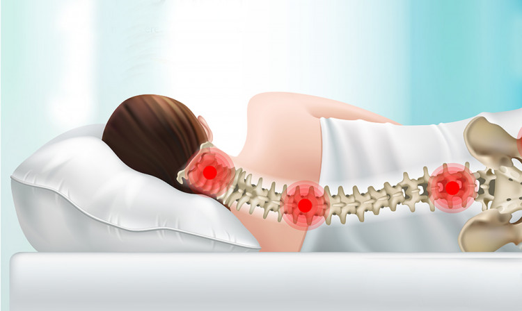 При дискомфорт в шийния отдел на гръбначния стълб не трябва да спите на висока възглавница