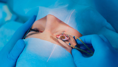 Покрива ли изцяло НЗОК операцията при отлепване на ретината?