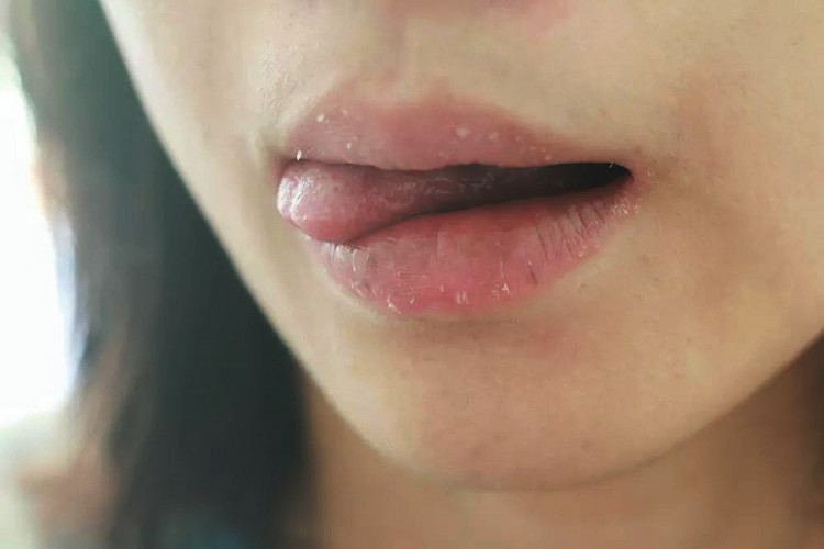 По какви причини изтръпват езикът и устните?