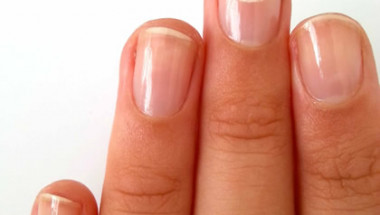 Кои проблеми с ноктите говорят за опасна болест