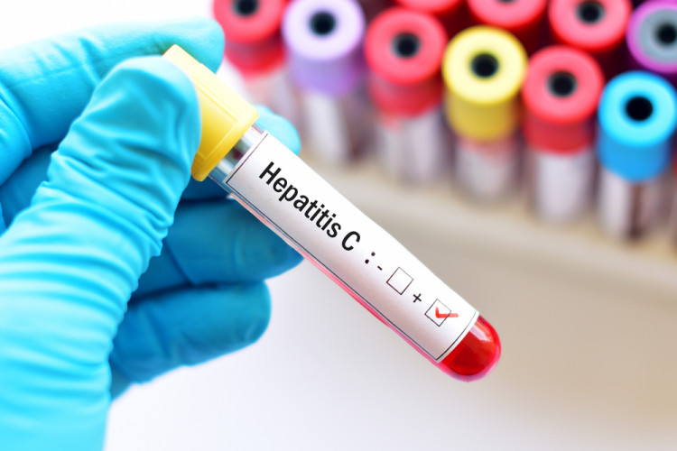 Хепатит С често протича без жълтеница