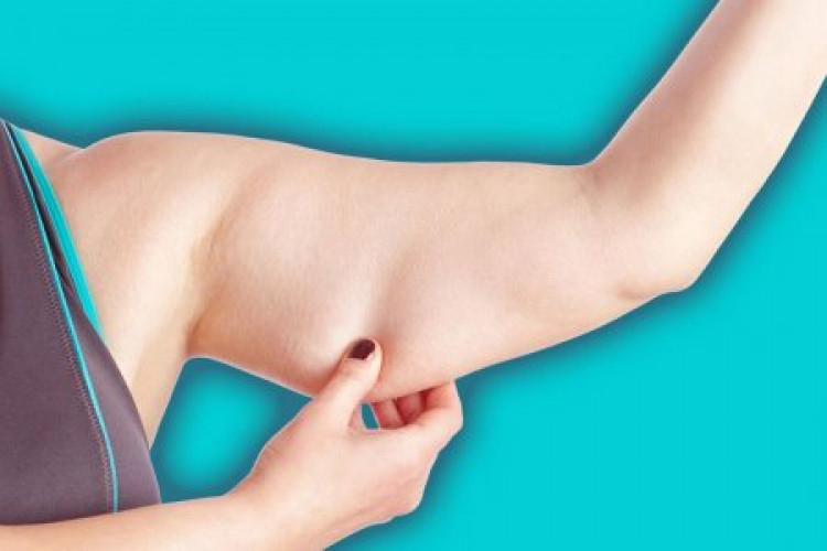 Експерт обясни как да отслабнете, за да не увисне кожата