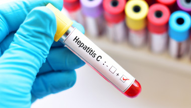 Част от хората с хепатит С се самоизчистват от вируса