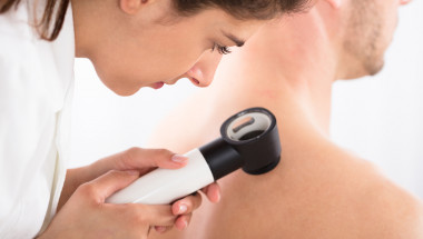 Папилома вирусът предпазва ли от рак на кожата?