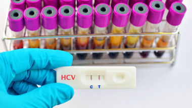 Тестват безплатно за хепатит C в цялата страна
