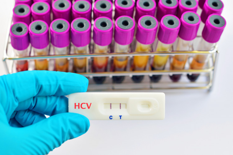 Тестват безплатно за хепатит C в цялата страна