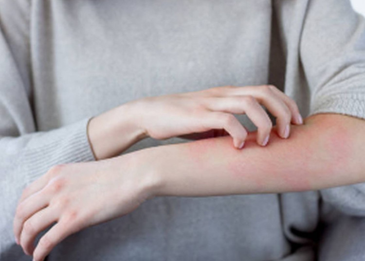 6 кожни симптома алармират за сериозни заболявания