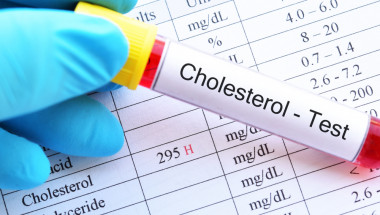 Здравословни продукти, които крият рискове при висок холестерол