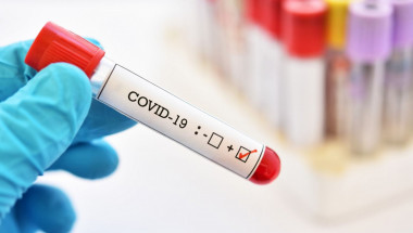 Проф. Аврамов:  Озонотерапията и високите дози витамин C са радикално лечение на коронавирус