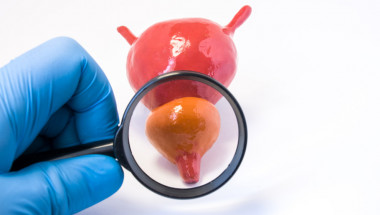 Какво покрива НЗОК при операция за отстраняване на простатата?