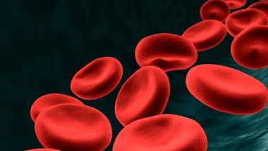 Кардиолог обясни как да разберете дали сте изложени на риск от кръвни съсиреци