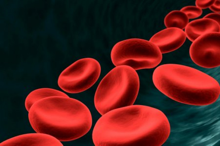 Кардиолог обясни как да разберете дали сте изложени на риск от кръвни съсиреци