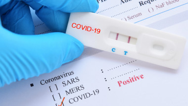 На какви изследвания имам право след положителен тест за коронавирус?