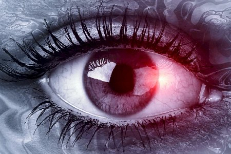 Червени очи: кога се нуждаете от лекарска помощ?