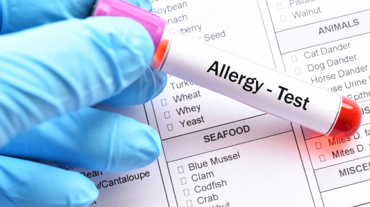 Съществува ли алергия към захарта?