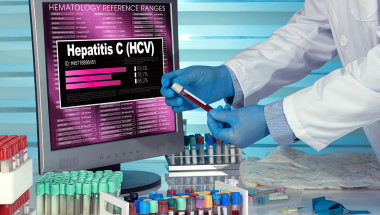 Силвана Лесидренска: Министерството отлага скрининга за хепатит С
