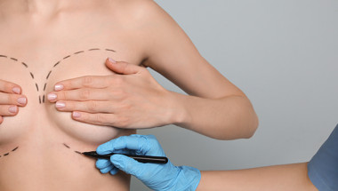 Пластичен хирург алармира: Тези жени да забравят за силикона! (18+)