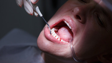 Доц. д-р Елена Фиркова: Пародонтитът е „тихият убиец“  на венците и зъбите