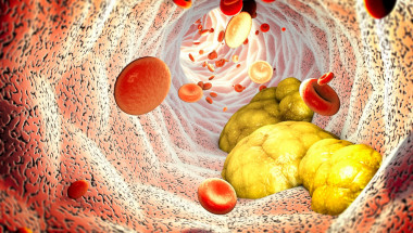 Генетично лекарство за висок холестерол ще се изпитва при хора