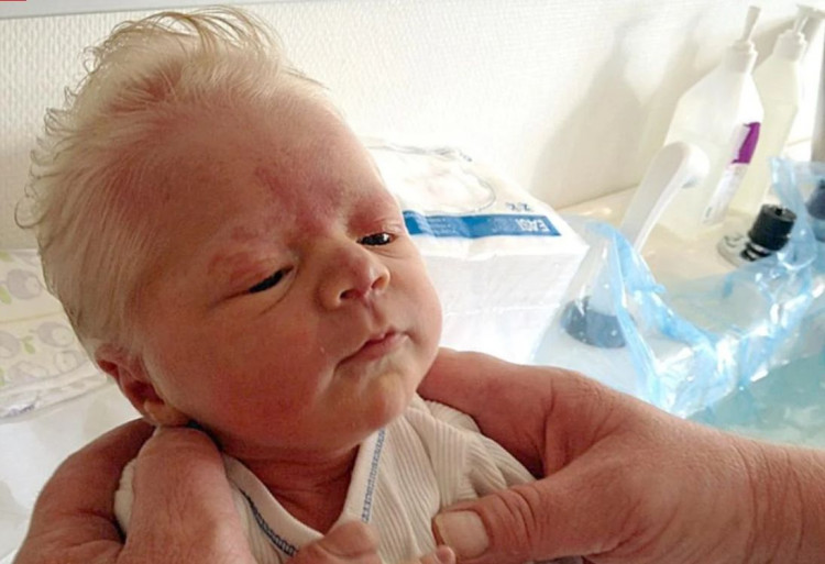 Бебе с посивели коси обърка лекарите ВИДЕО