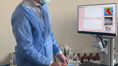 Уникален скенер за кожа получи спешната болница „Пирогов”