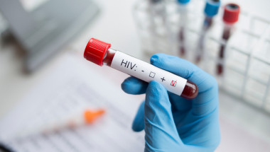 Една трета от новите болни  с ХИВ у нас са чужденци