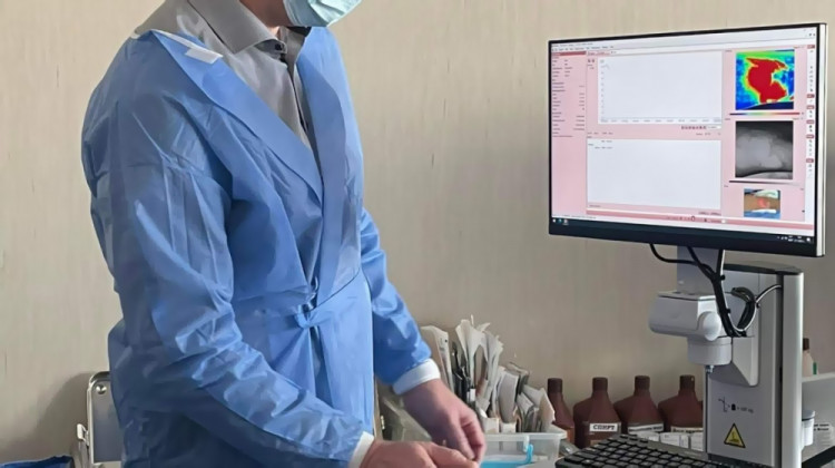 Уникален скенер за кожа получи спешната болница „Пирогов”