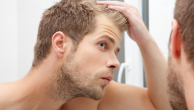 Учени установиха кои храни причиняват плешивост при мъжете