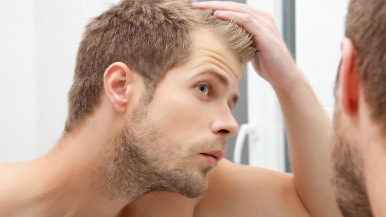 Учени установиха кои храни причиняват плешивост при мъжете