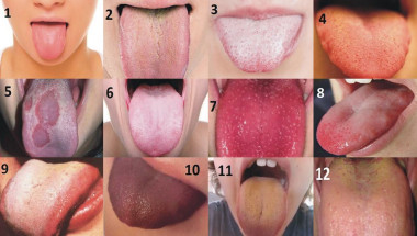 Какво казва състоянието на езика за здравето на вътрешните органи