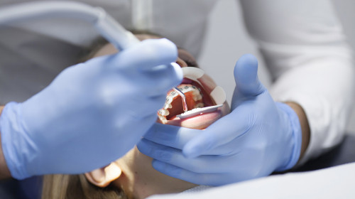 Ортодонтското лечение на лицева асиметрия в областта на долната челюст безплатно ли е?