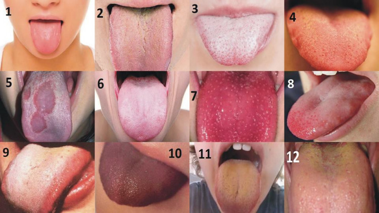 Какво казва състоянието на езика за здравето на вътрешните органи