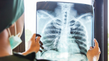 Д-р Веселин Давчев: „Краят на туберкулозата“  ще се поотложи