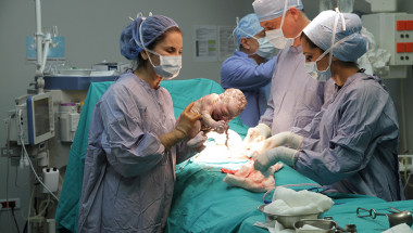 Проф. д-р Петър Петров, д.м.н.: Не трябва с лека ръка да се подхожда към раждането със секцио