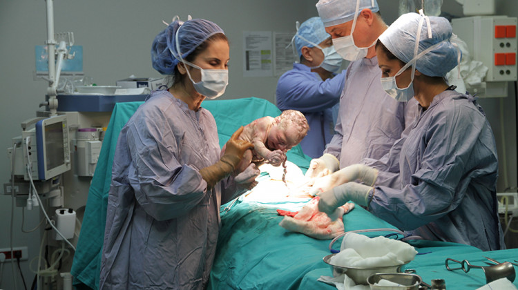 Проф. д-р Петър Петров, д.м.н.: Не трябва с лека ръка да се подхожда към раждането със секцио